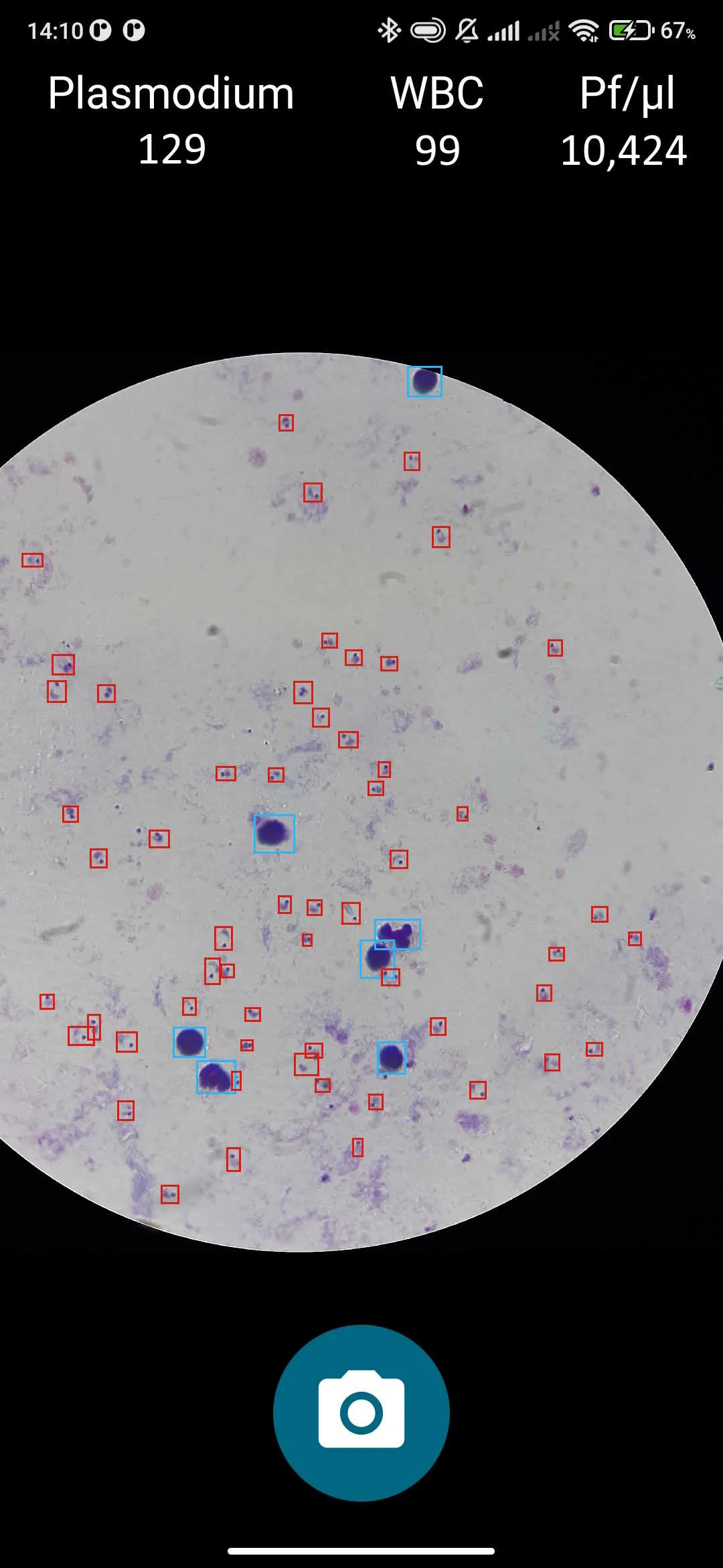 Thick-smear acquisition in Plasmodium Finder