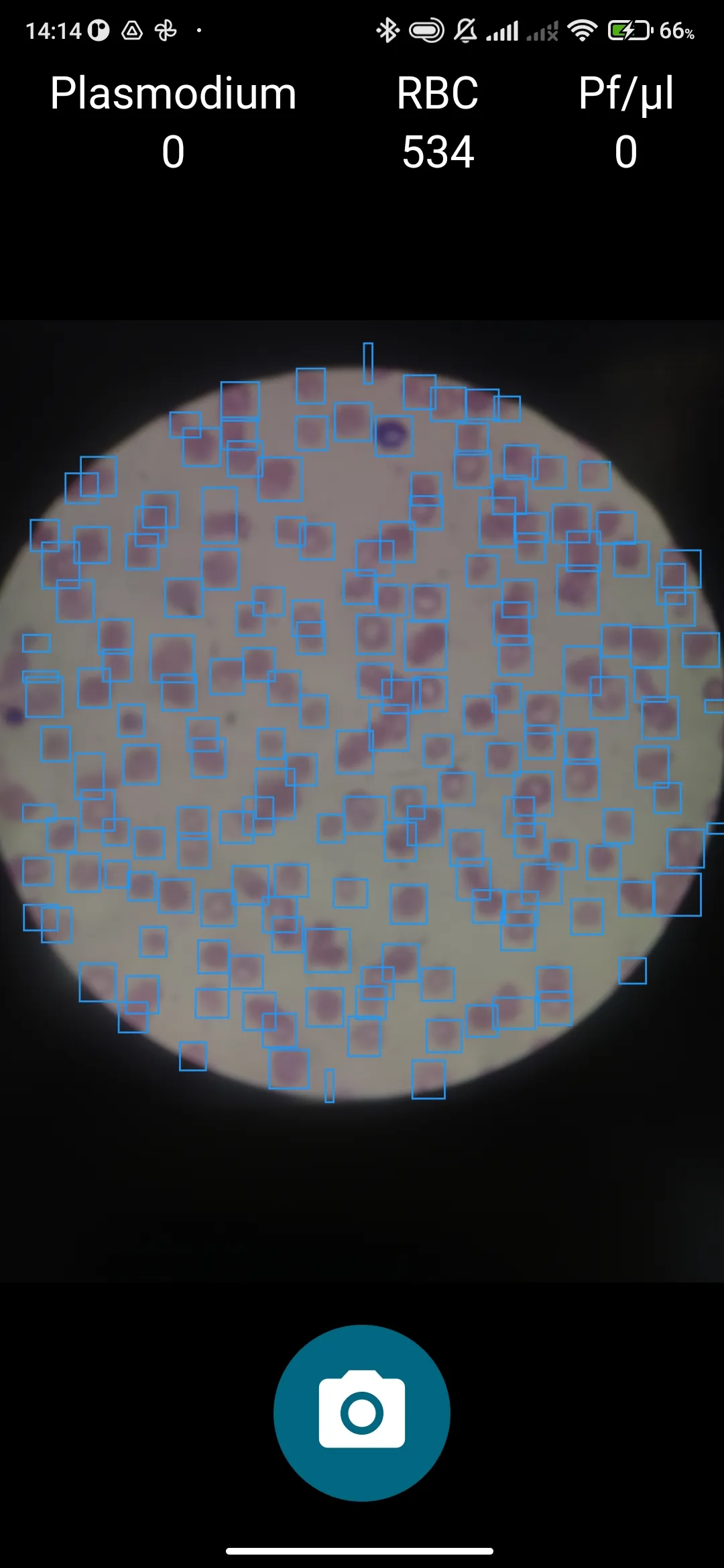 Thin-smear acquisition in Plasmodium Finder