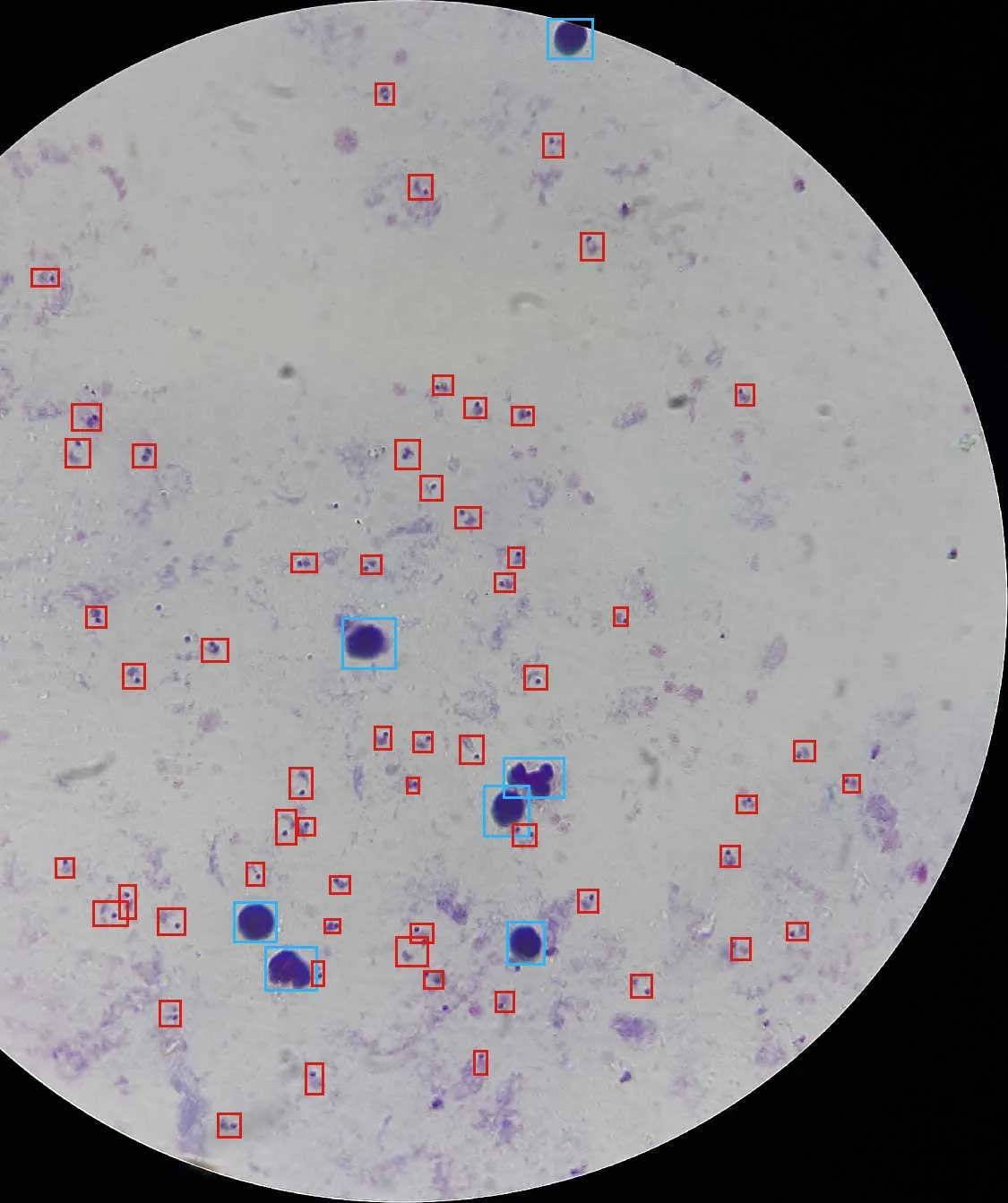 Thick blood smear shown in the Plasmodium Finder acquisition interface
